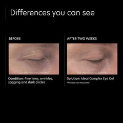 Ideal Complex Eye Gel .5 oz. - BAY WINDOW